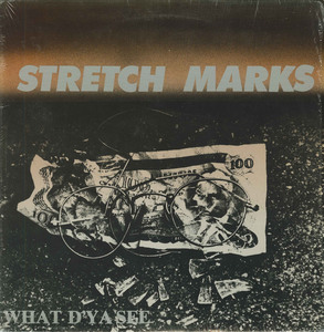 Stretch marks what dya see front