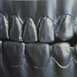 Cd change of heart steelteeth front