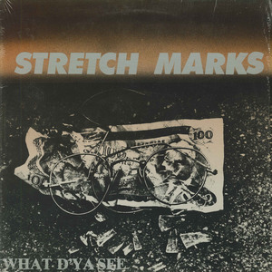 Stretch marks what dya see front
